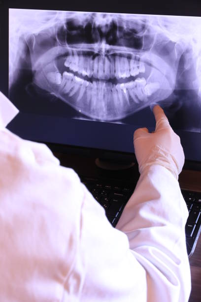 Best Emergency Denture Repair in Prosser, WA