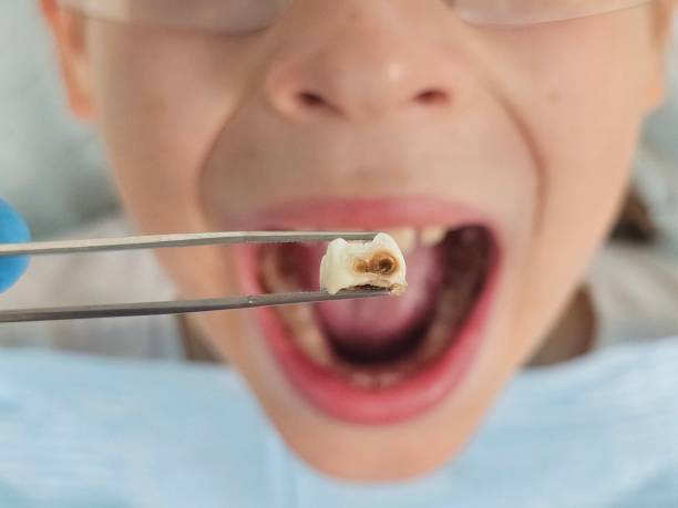 Best Emergency Treatment for Jaw Pain or Injury in Prosser, WA